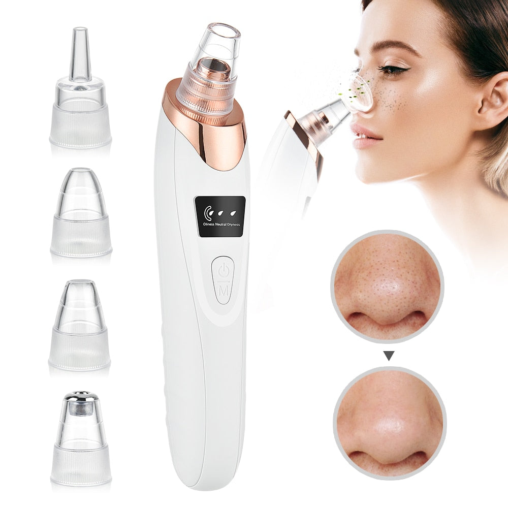 Aspirateur Points Noirs Électrique – Nettoyant Pores & Exfoliant Visage | Vélyra